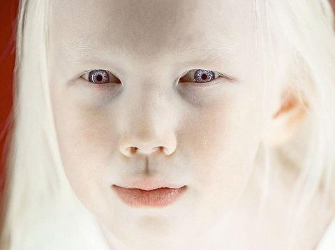 Foto: Nariyana, Putri Salju dari Siberia yang Menarik Atensi Dunia