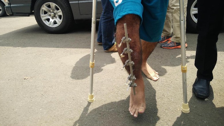 Diadili, Pelaku Pembunuhan Pulomas Masih Jalan Pakai Alat Bantu Diadili, Pelaku Pembunuhan Pulomas Masih Jalan Pakai Alat Bantu