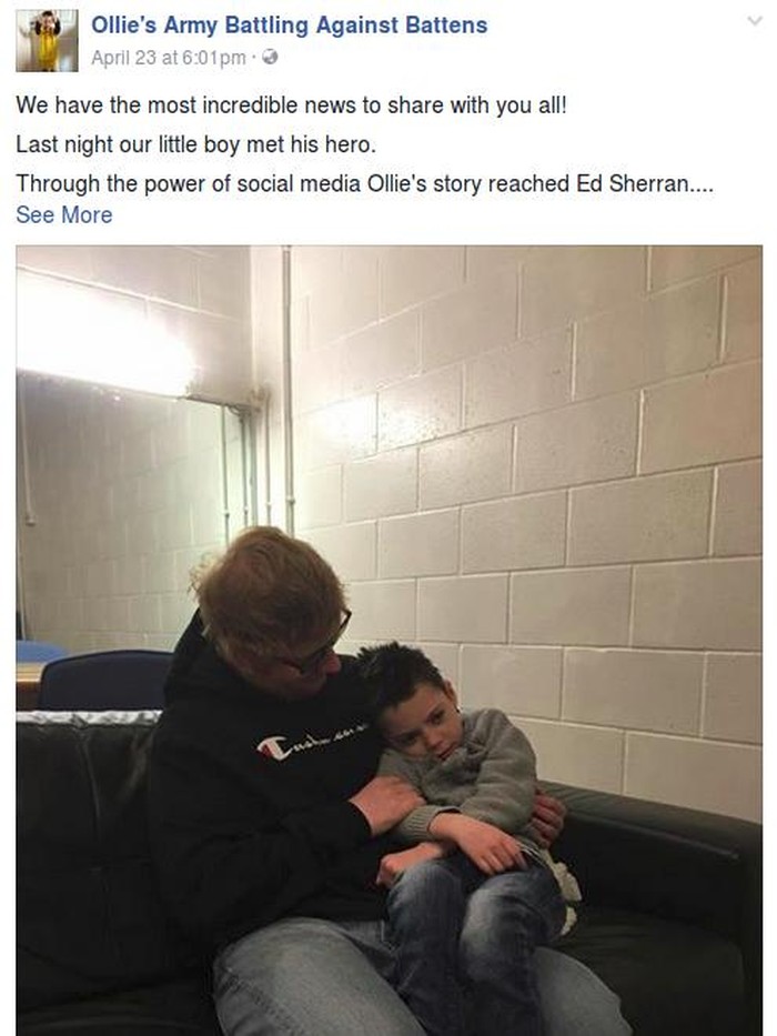 So Sweet! Saat Ed Sheeran Bertemu Bocah dengan Kondisi Genetik Langka