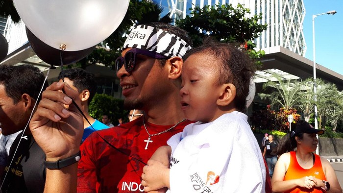 Curhat Lala, Ibu dari Anak dengan Kelainan Langka Noonan Syndrome