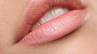 Terlihat sepele, namun cuaca panas juga bisa menyebabkan perubahan warna pada bibir. Ini terjadi karena cuaca panas menyebabkan bibir yang kering dan pecah-pecah. (Foto: iStock)