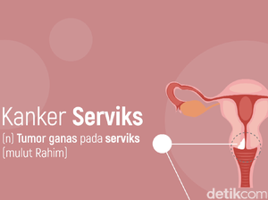Seperti Apa Ciri-ciri Kanker Serviks Seperti Dialami Jupe?