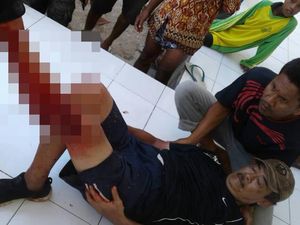 Turis yang Diserang Komodo, Sempat Minta Foto Aneh-aneh