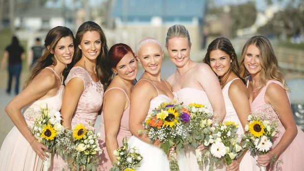 Viral, Pengantin Wanita yang Tampil Botak di Hari Pernikahan