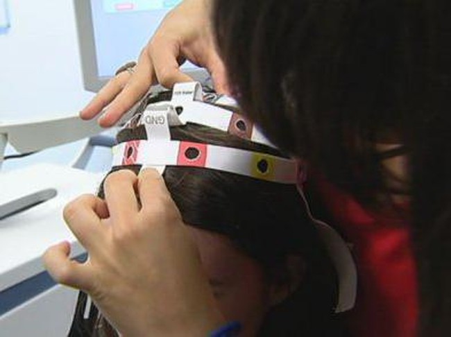 Aneka Terapi Setrum yang Diyakini Bermanfaat Bagi Kesehatan