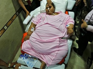 Operasi Kedua, Bobot Wanita Terberat di Dunia Turun Hingga 300 kg