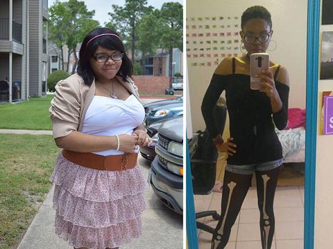 Lihat, Perubahan Mengagumkan 10 Orang Gemuk yang Sukses Turunkan Berat