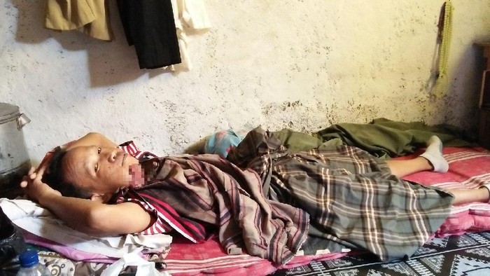 Fathurohmat, Pengidap Tumor Ganas di Cilegon Butuh Bantuan