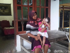Balita Piatu Penderita Tumor Pantat Tak Punya Biaya Berobat