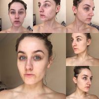 Setahun Tak Cuci Muka Pakai Sabun, Kondisi Wajah Wanita Ini Mengejutkan