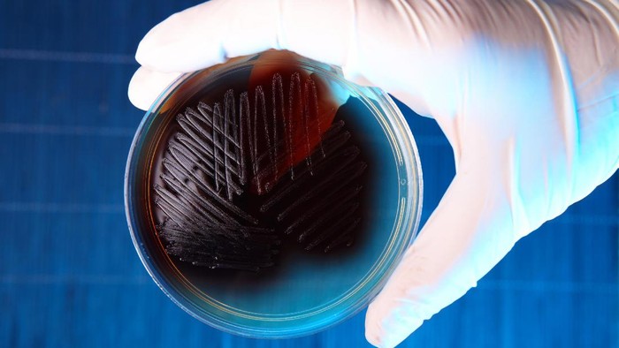 ilustrasi bakteri Hand in glove holding Petri plate with bacteria Enterococcus Faecalis