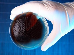 Bakteri Ini Makin Kebal! 45 Persen Antibiotik di Indonesia Tak Bisa Membunuhnya