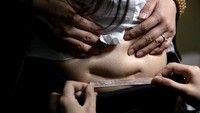 Hailei terinspirasi oleh seniman tato asal Amerika Serikat yang pernah mentato bekas luka pada wanita yang menderita KDRT. REUTERS/Aly Song.