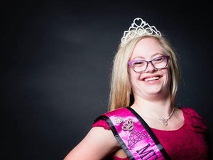 Pertamakalinya, Wanita Down Syndrome Jadi Finalis Ratu Kecantikan di Amerika