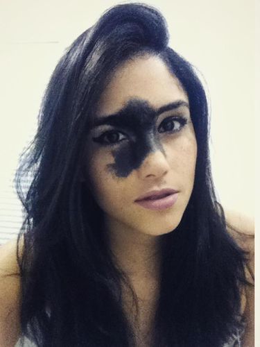 Foto: Kecantikan Mariana yang Punya Tanda Lahir Besar di Wajah