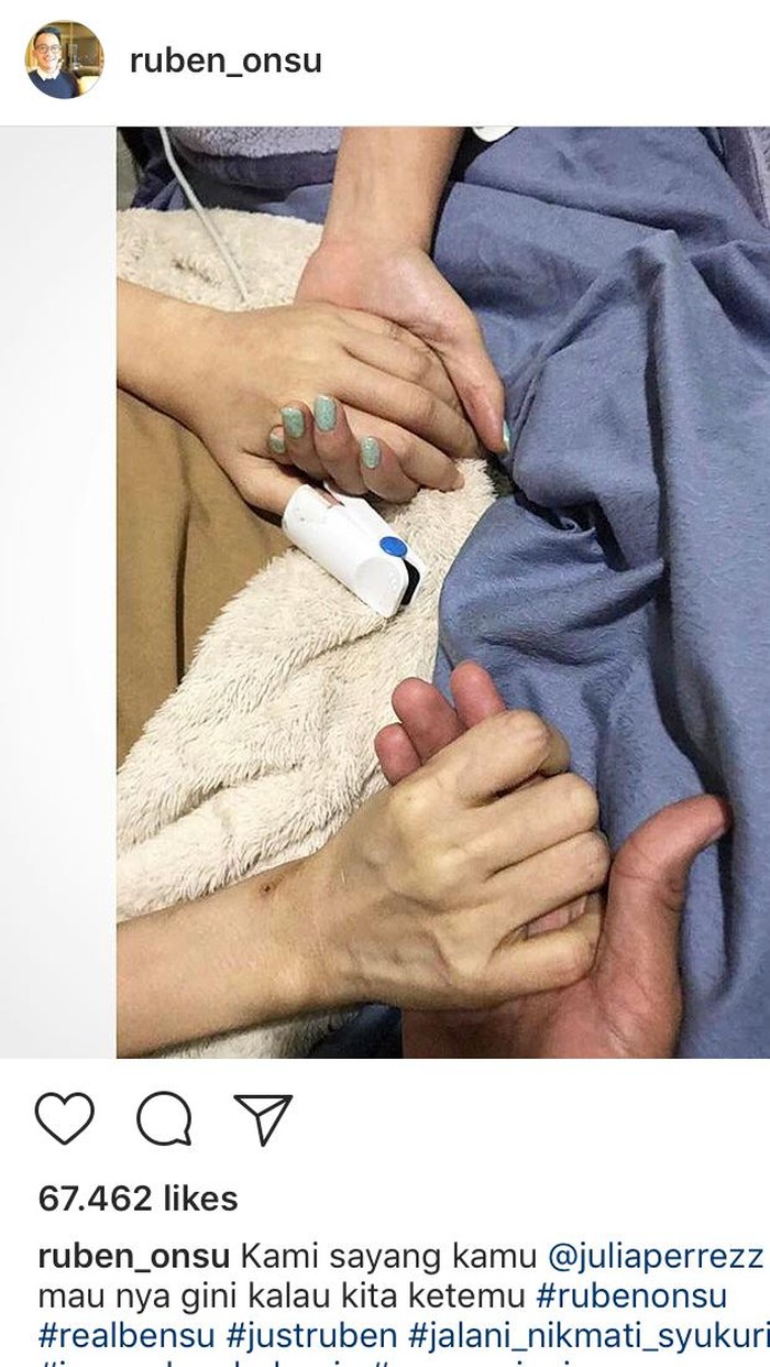 Jupe Pakai Oksimetri di Ibu Jari, Apa Fungsinya?