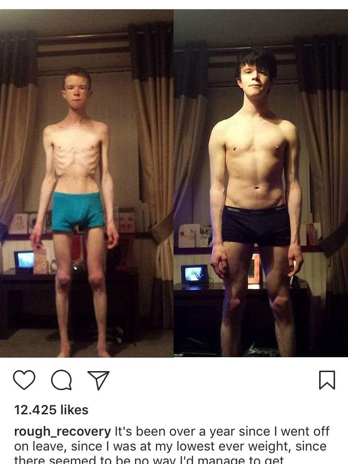 Kisah Pria Sembuh dari Anoreksia Berkat Acara Kompetisi Memasak