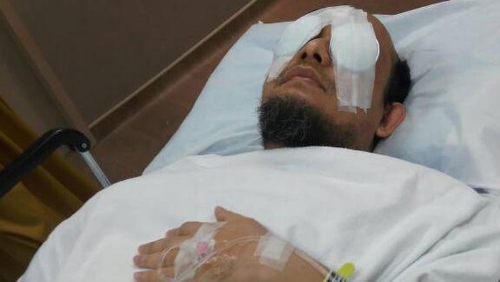 Novel Baswedan Jalani Operasi Pemasangan Membran Mata