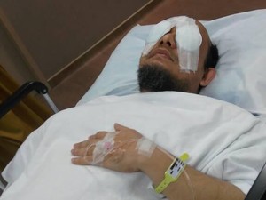 Pasca Operasi, Radang di Mata Kiri Novel Berkurang