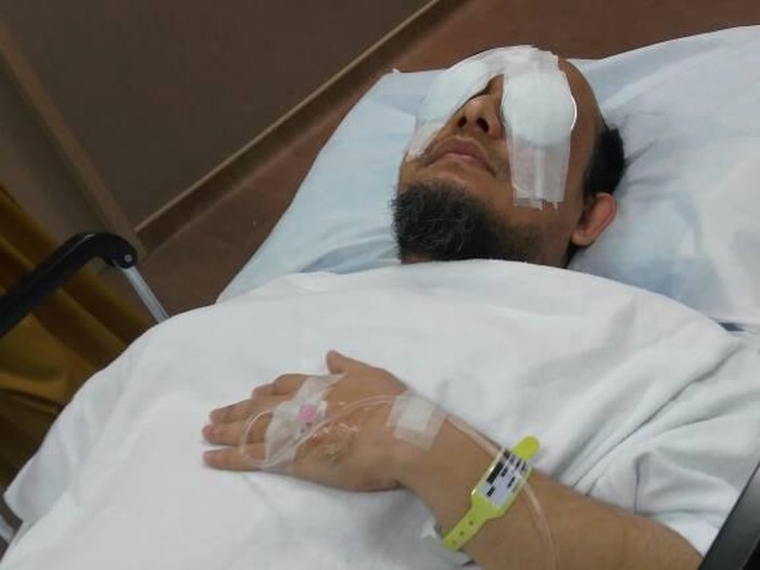 Pasca Operasi, Radang di Mata Kiri Novel Berkurang