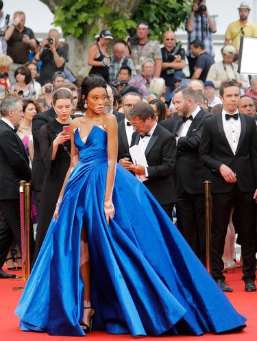 Foto: Model Berkulit Belang Curi Perhatian di Red Carpet Cannes