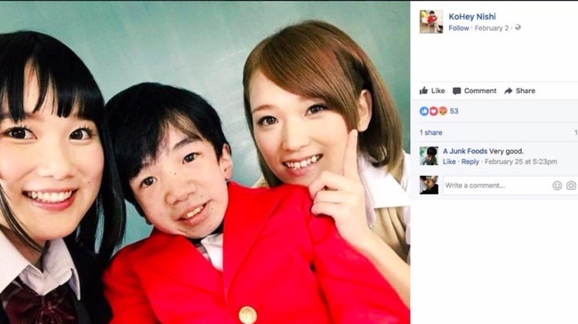 Seperti Kohey Nishi, Orang-orang Ini Berhenti Tumbuh di Usia Muda