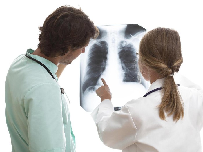 General surgeon explainnig to intern the details of lung disease on x-ray picture