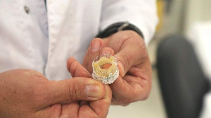 Kantung Jantung Sapi Dijadikan Implan Katup Jantung Manusia