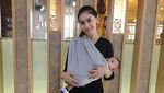 Makin Cantik, Melody Prima Dituduh Oplas