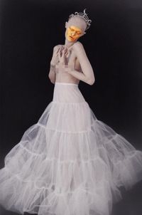 Mirip Manekin, Model dengan Kelainan Genetik Langka Curi Perhatian Dunia