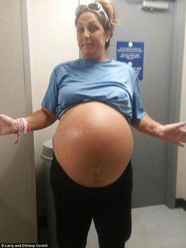 Kondisi Chrissy saat mengandung Carleigh, seperti sedang hamil kembar (Foto: Larry Fizer)