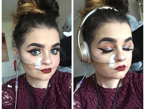 Kisah Inspiratif Makeup Artist Pengidap Sindrom Langka