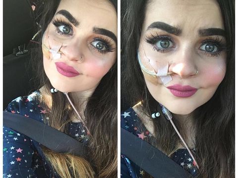 Kisah Inspiratif Makeup Artist Pengidap Sindrom Langka