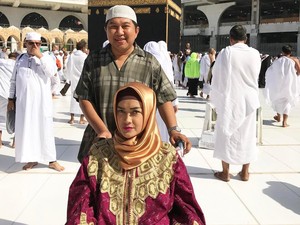 Cerita Jupe Ngamen Raup Belasan Juta Sembari Sembunyikan Kepayahannya