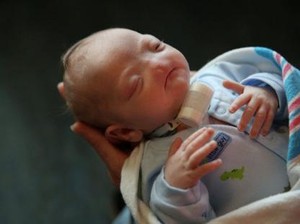 Lahir Tanpa Hidung, Bocah Berjuluk Miracle Baby Ini Akhirnya Meninggal