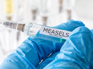 Lebih Menular dari Omicron, 1 Kasus Campak Bisa Sebarkan Virus ke 18 Orang