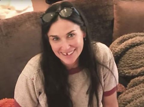 Demi Moore Ompong Karena Stres 