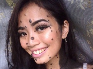 Wajah dan Tubuh Dipenuhi Tahi Lalat, Gadis Ini Ikut Kontes Kecantikan