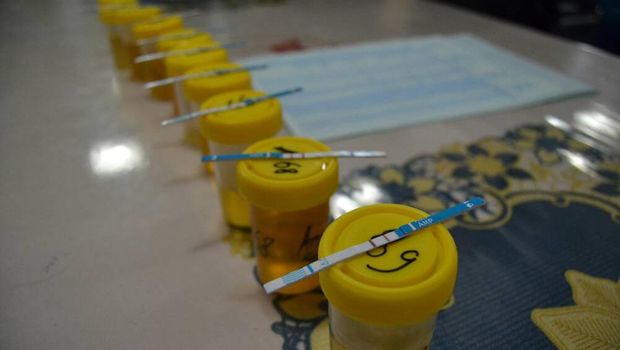 Semua tes urine hasilnya negatif