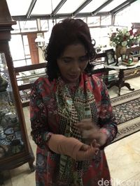 Tangan Menteri Susi cedera.