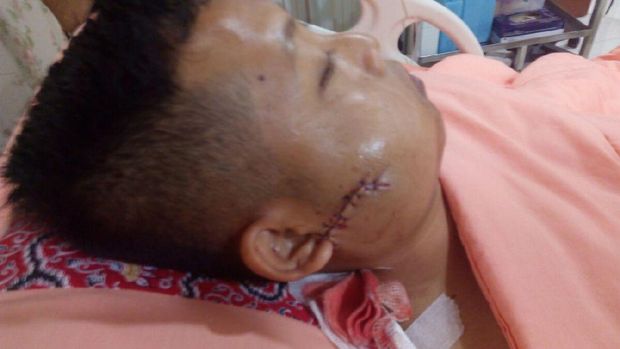   Operasi 2 Anggota Brimob Korban Teror Penusukan Berjalan Lancar