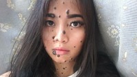 Evita Delmundo (20) terlahir dengan kondisi hampir seluruh tubuhnya tertutup oleh tahi lalat. Kondisi ini tidak berbahaya namun menyebabkan Evita sering dibully saat masih kecil. (Foto: Instagram/evita_delmundo)