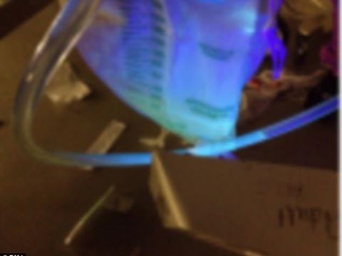 Urinenya yang berpendar membantu dokter mendiagnosa penyebab keluhan yang dialami oleh sang pria.