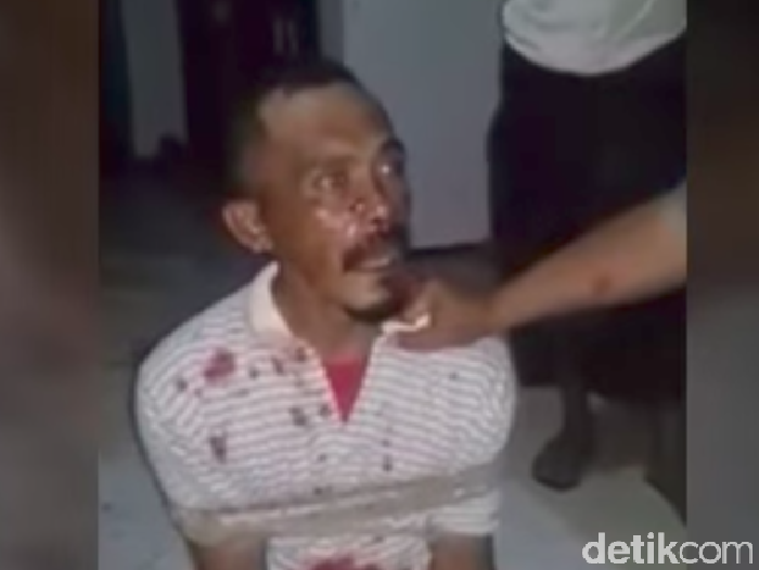 Maling Dibakar Hidup-hidup di Pamekasan, Polisi: Dia Terluka di Kaki