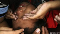 Seorang anak menangis saat disunat.