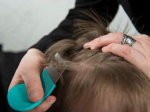 Selain Kebersihan, Kebiasaan Ini Juga Bisa Undang Kutu ke Rambut