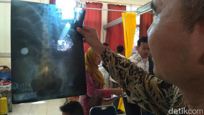 Meski Santet Tak Ada Dalam Ilmu Medis Dokter Tetap Percaya