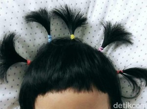 Kisah Bocah India yang Tubuh dan Wajahnya Penuh Rambut