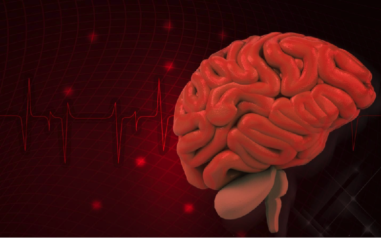 Menangani Stroke Akibat Sumbatan Pembuluh Darah di Otak Menangani Stroke Akibat Sumbatan Pembuluh Darah di Otak