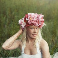 Bailey Pretak berhasil terpilih jadi Miss Pennsylvania dengan kondisi kulit tubuh dan wajah bersisik parah. Bailey mengidap lamellar ichtyosis. Kondisi genetik langka yang membuat kulitnya kering, pecah-pecah, hingga mengelupas. Penyakit yang menyerang satu dari 200.000 orang di dunia ini belum bisa disembuhkan. Karena kelainan tersebut, Bailey sempat ditindas dan dijuluki nama-nama kurang menyenangkan ketika kecil. Foto: Facebook Bailey Pretak